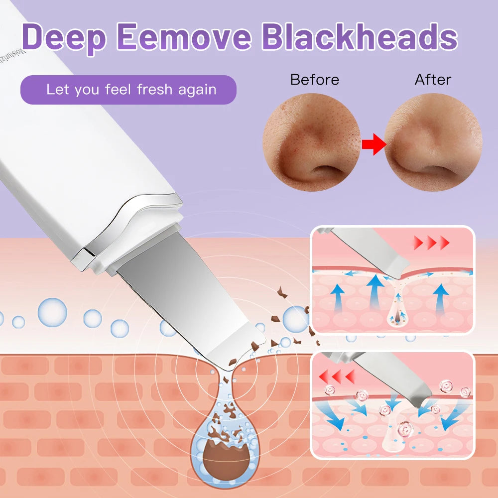 With Box Ultrasonic Skin Scrubber Vibration Face Spatula Peeling Blackhead Remover Facial Lifting Cleansing Ultrasonic Skin Care