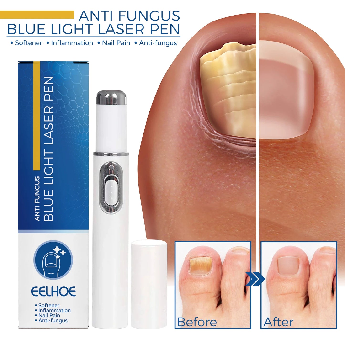 Healthy Body Laser Pen Leg Foot Care Tool for You Maintain Optimal Wellness