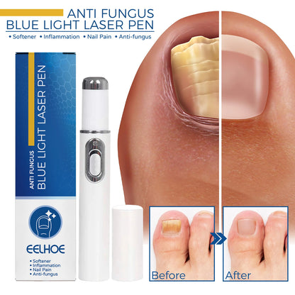 Healthy Body Laser Pen Leg Foot Care Tool for You Maintain Optimal Wellness