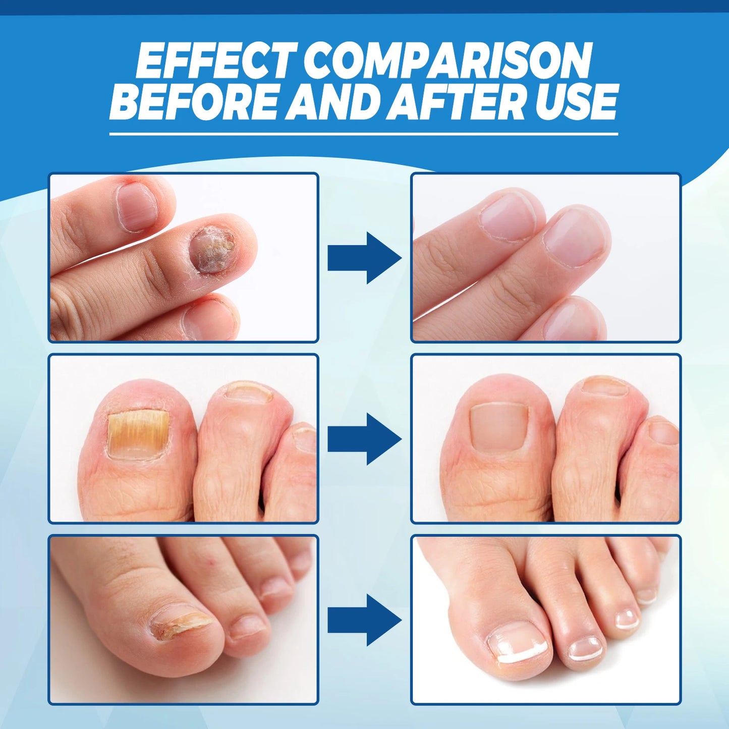 Healthy Body Laser Pen Leg Foot Care Tool for You Maintain Optimal Wellness