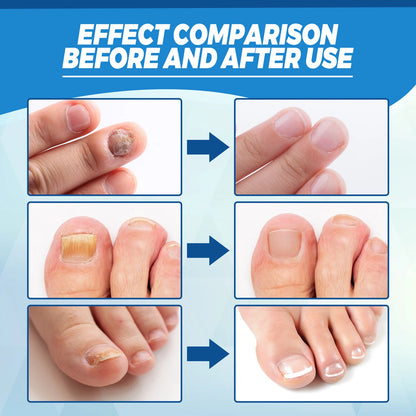 Healthy Body Laser Pen Leg Foot Care Tool for You Maintain Optimal Wellness