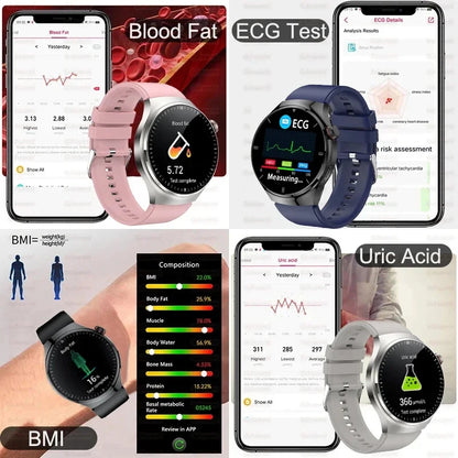 2026 New Non Invasive Health Monitoring Smartwatch Blood Lipids Uric Acid Heart Rate Body Temperature Bluetooth Call Smart Watch