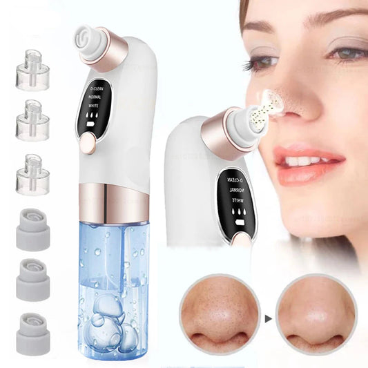 Vacuum Blackhead Remover - Fitmora™
