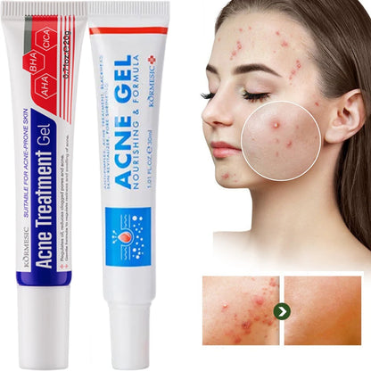 Acne Removal Cream Anti-Acne Repair Redness Pimple Spots Gel Deep Cleaning Pore Oil Control Moisturizing Skin Care